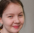 В Тюмени проходит реабилитацию 14-летняя Оля. Девочке с гигантской аневризмой делали операцию 25 часов - Комсомольская правда